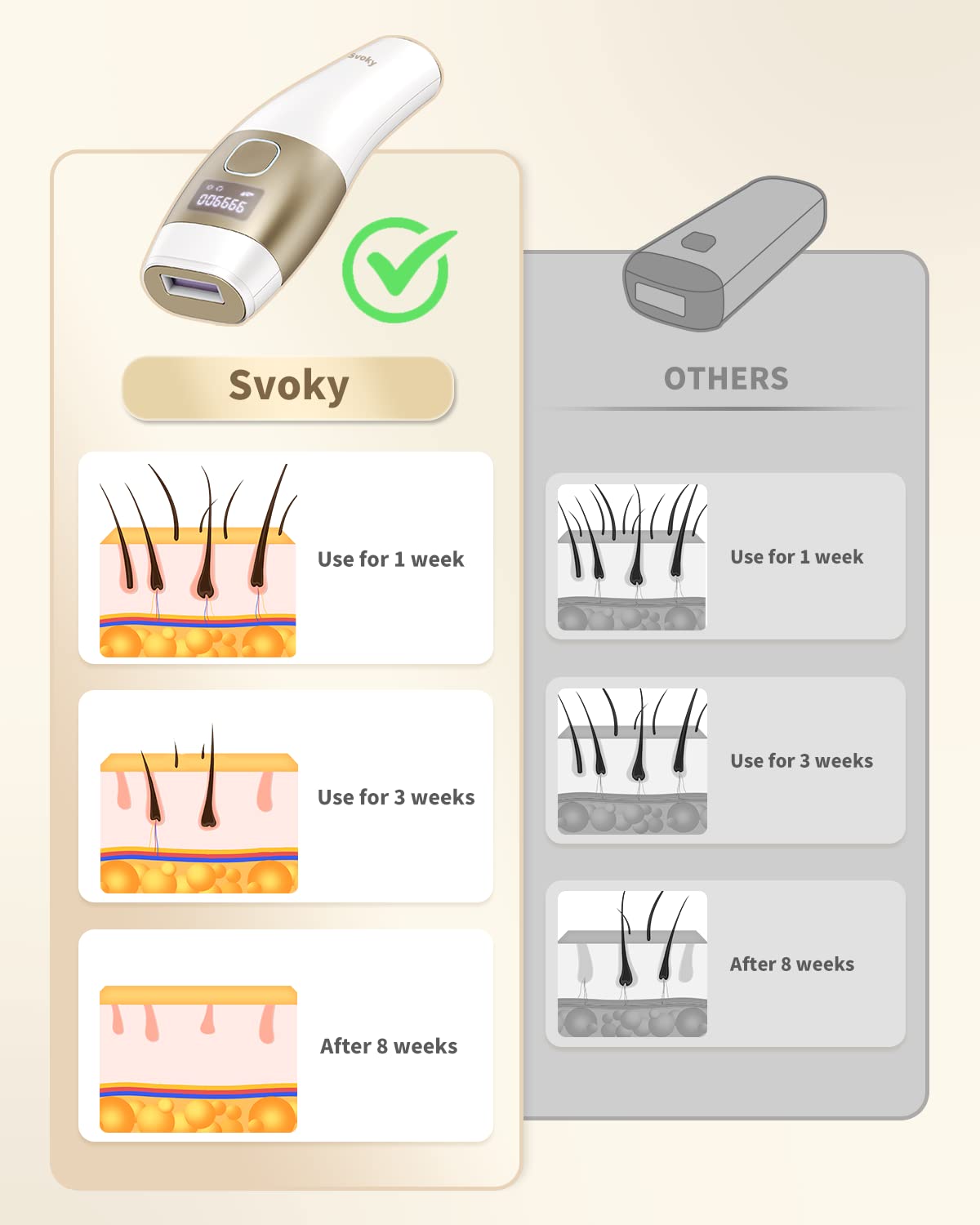 Svoky IPL Laser Hair Removal Device